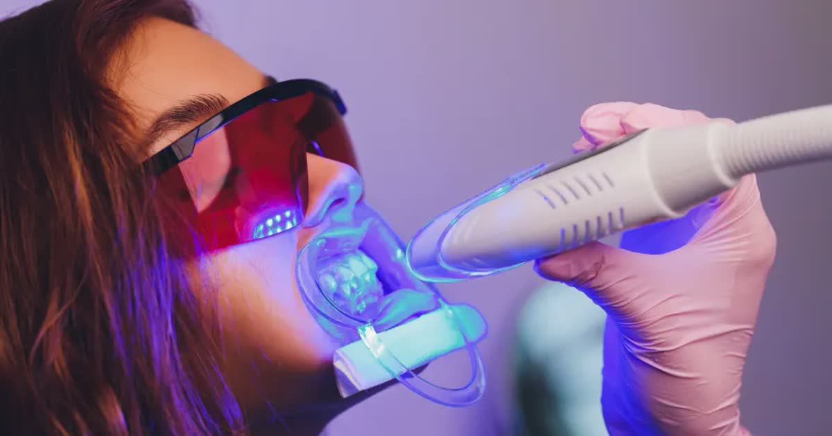 Benefits Of Dental Implants