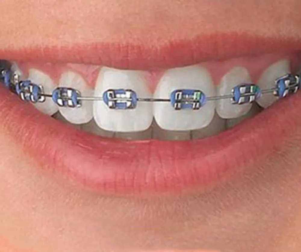 Orthodontist in Coimbatore