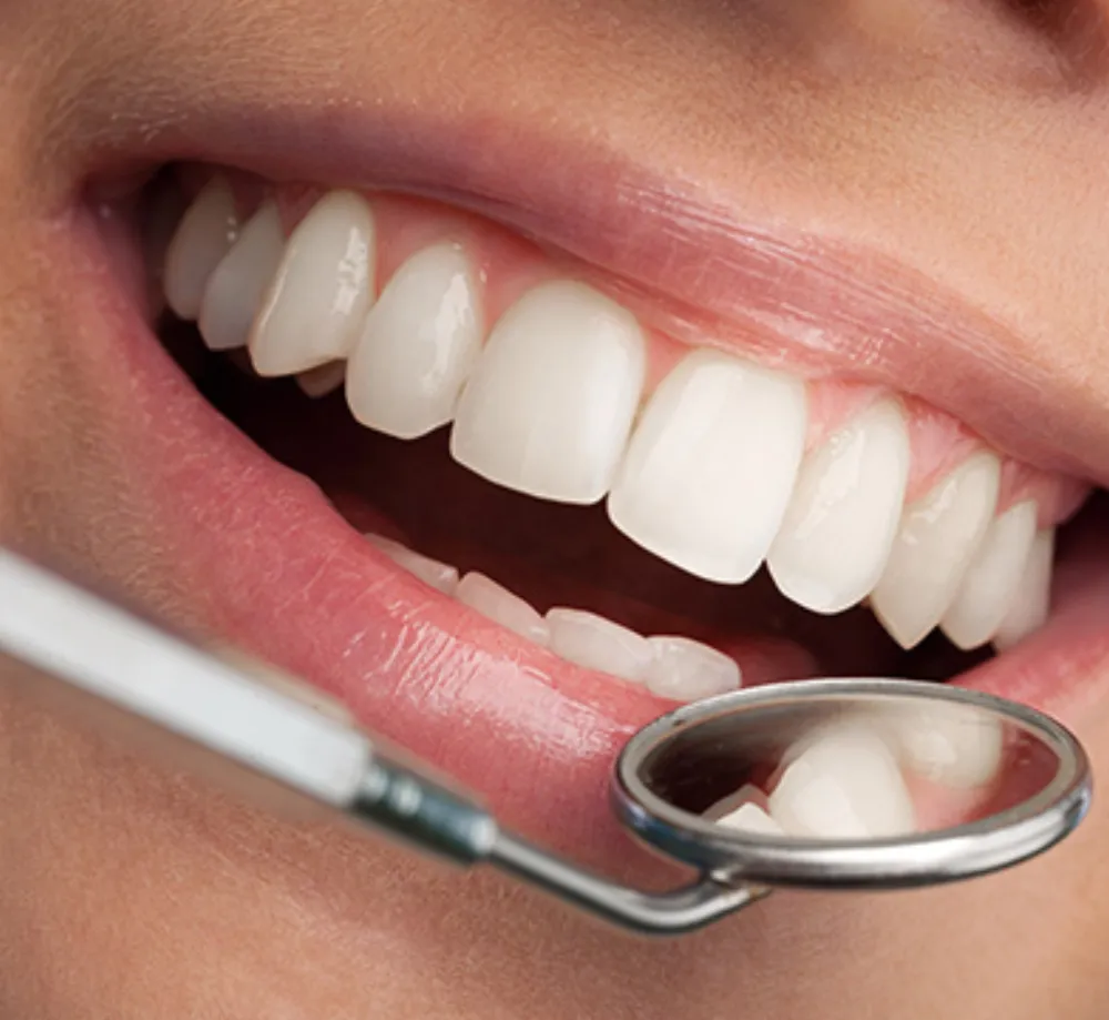 Smile Makeover in Coimbatore