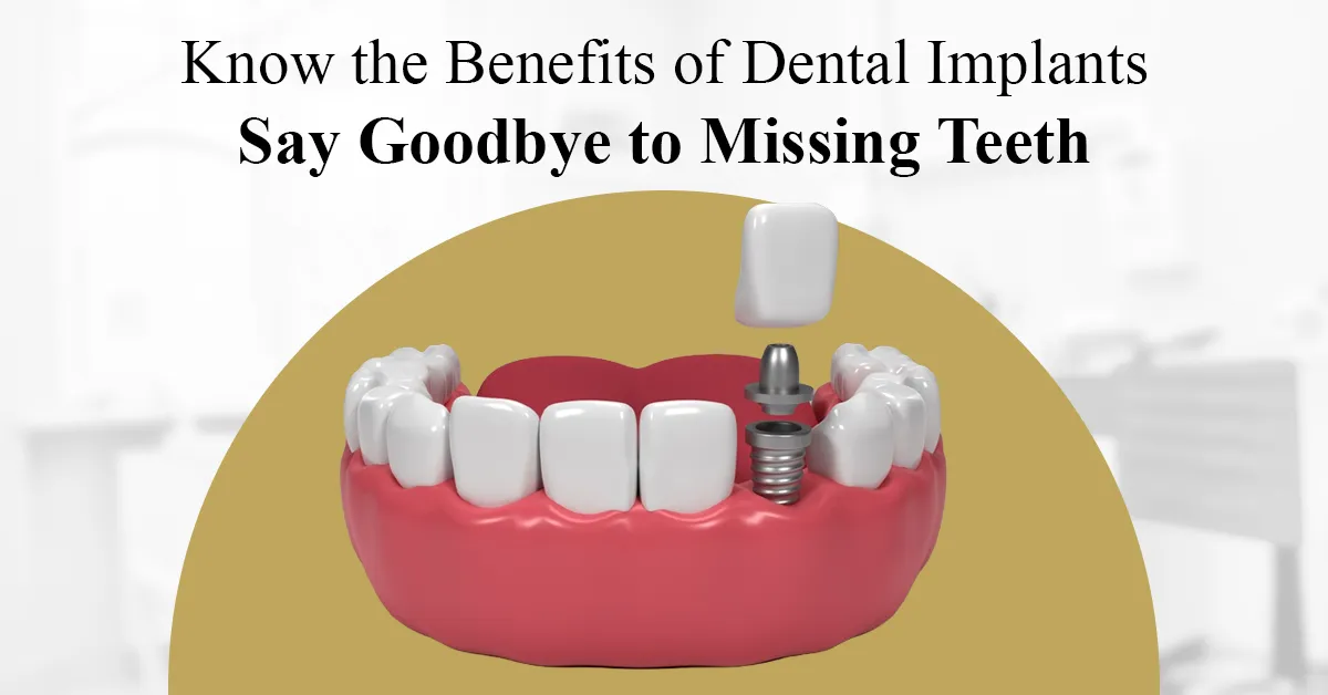 dental implants hospital in coimbatore 