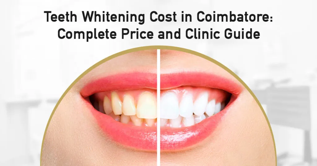 teeth whitening cost in coimbatore