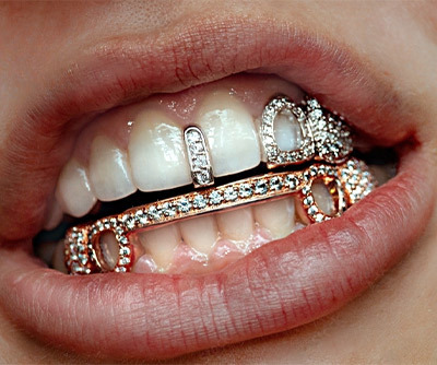 tooth jewellery