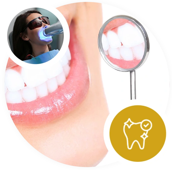 tooth whitening treatment in coimbatore