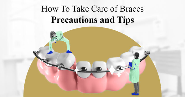 take care of braces