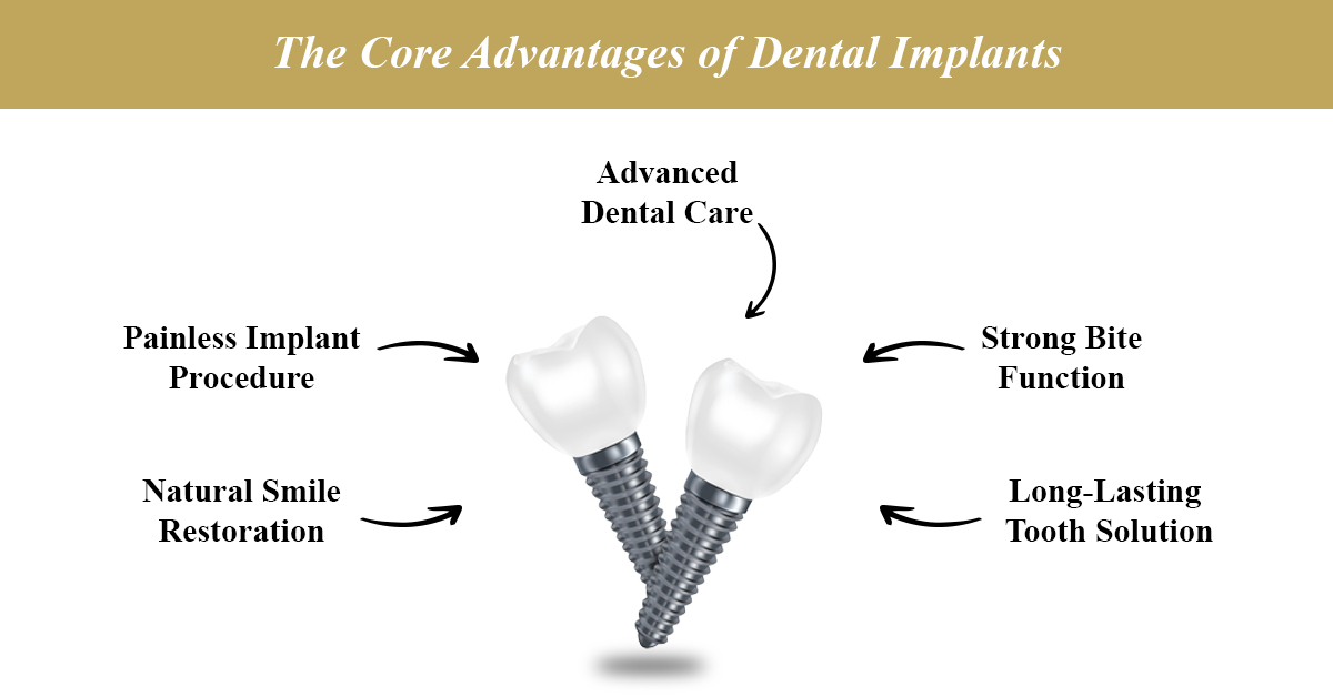 dental implants: all on four, single tooth, full mouth