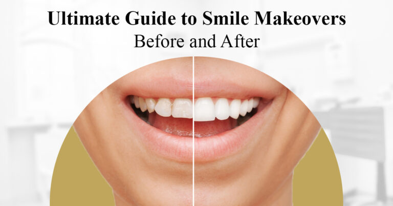 ultimate guide to smile makeovers: before and after