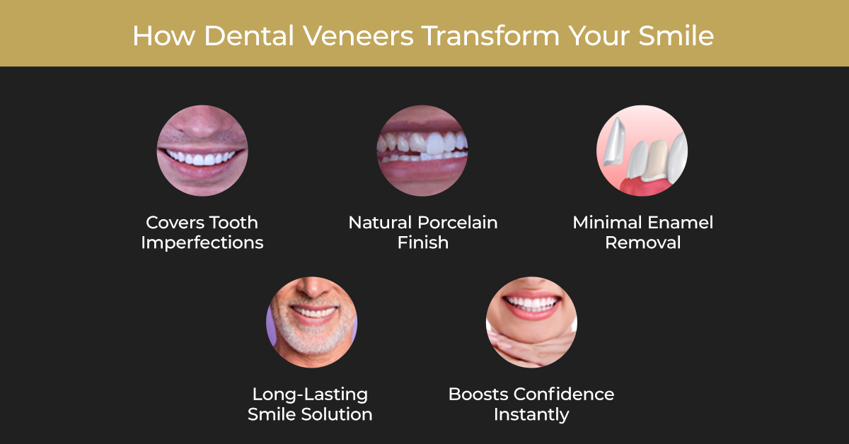 best dental veneers in coimbatore