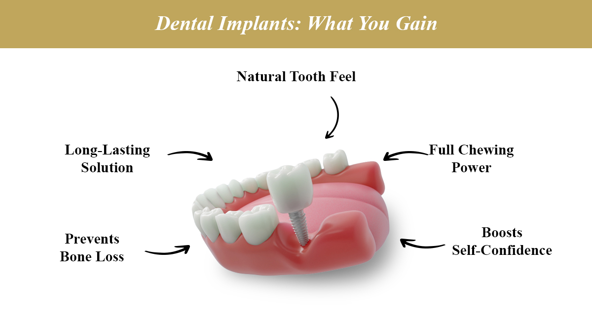 dental implants hospital in coimbatore