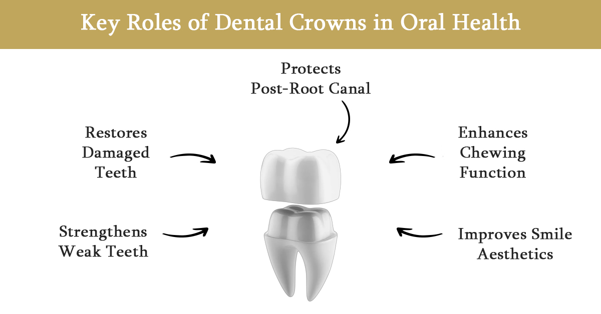 crown dental crown clinic coimbatore