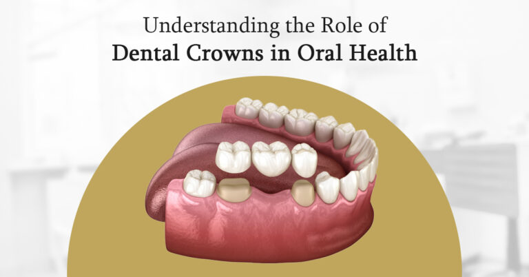 crown dental crown clinic coimbatore