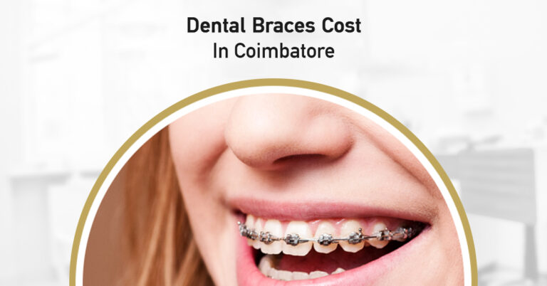 cost of dental braces in coimbatore