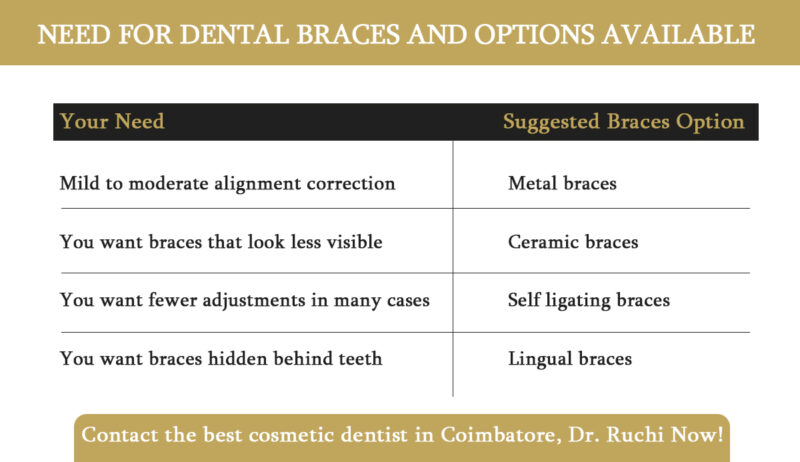 dental braces treatment in coimbatore