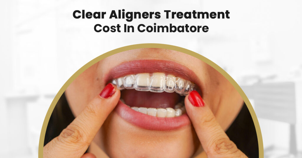 clear aligners treatment cost in coimbatore