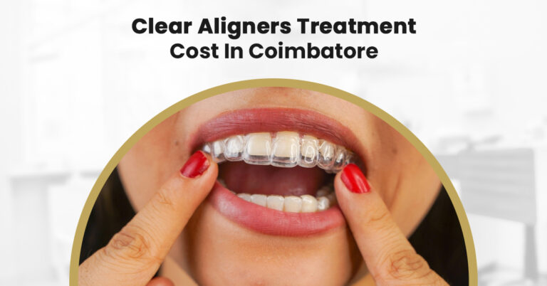 clear aligners treatment cost in coimbatore