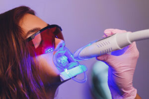 Close-up portrait of a female patient at dentist in the clinic. Teeth whitening procedure with ultraviolet light UV lamp.