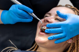 dental-procedure-installing-braces-close-up-dentistry-braces-teeth
