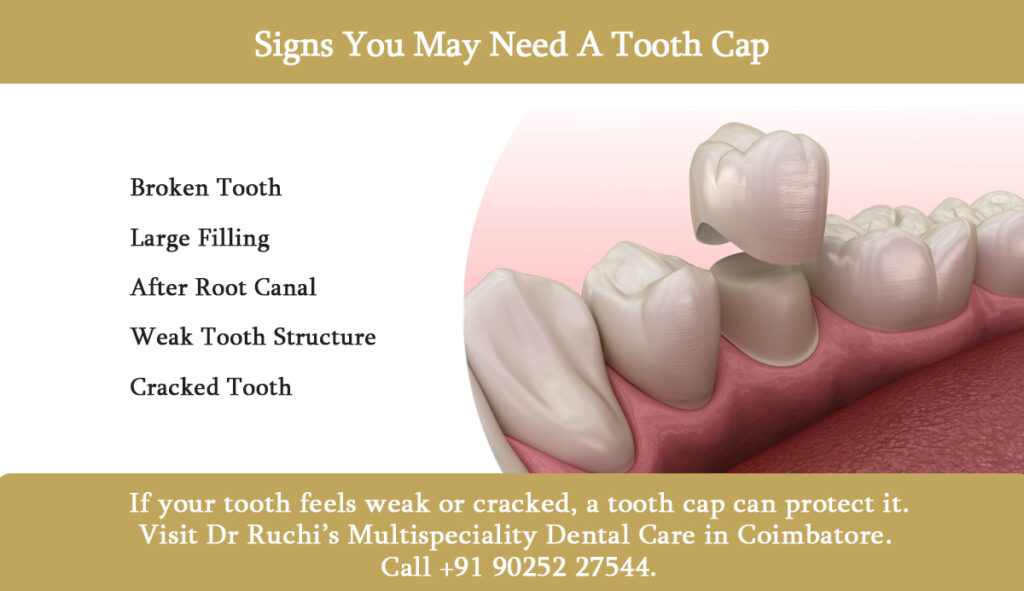 signs you may need a tooth cap