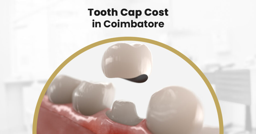 tooth cap cost in coimbatore